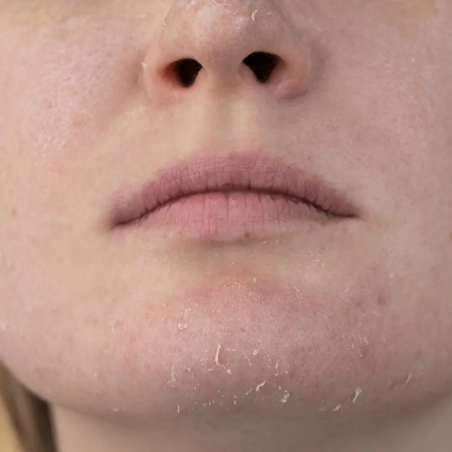 🌵✨ مراقبت تخصصی پوست خشک – راهنمای علمی و کامل